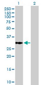 ECHDC1 Antibody in Western Blot (WB)