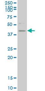 HDAC8 Antibody in Western Blot (WB)