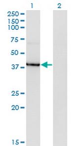 HDAC8 Antibody in Western Blot (WB)