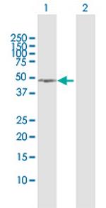 NSFL1C Antibody in Western Blot (WB)