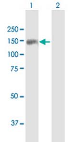 TDRD1 Antibody in Western Blot (WB)