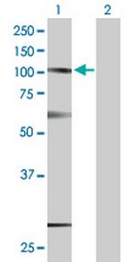 SUSD2 Antibody in Western Blot (WB)