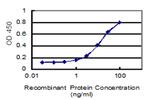 KIAA1217 Antibody in ELISA (ELISA)