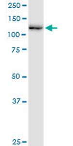 RNF20 Antibody in Western Blot (WB)