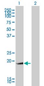 GKN1 Antibody in Western Blot (WB)