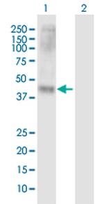 SLC7A10 Antibody in Western Blot (WB)