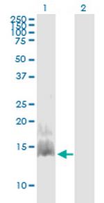 CCL28 Antibody in Western Blot (WB)