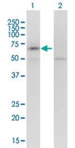 KCNQ5 Antibody in Western Blot (WB)