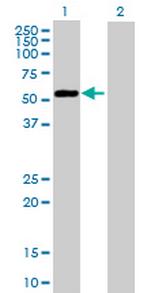 BCCIP Antibody in Western Blot (WB)