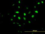 BCCIP Antibody in Immunocytochemistry (ICC/IF)