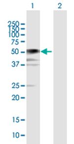 BCCIP Antibody in Western Blot (WB)