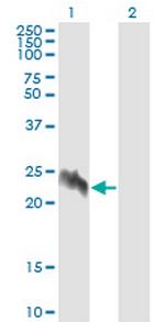 EIF5A2 Antibody in Western Blot (WB)