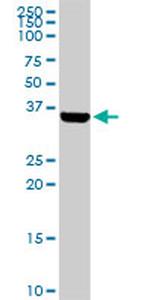 BARHL1 Antibody in Western Blot (WB)