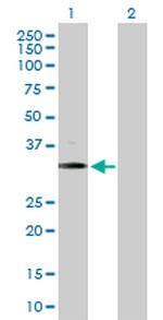 BARHL1 Antibody in Western Blot (WB)