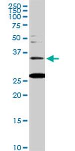 BARHL1 Antibody in Western Blot (WB)