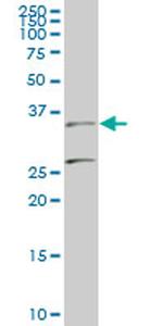 BARHL1 Antibody in Western Blot (WB)