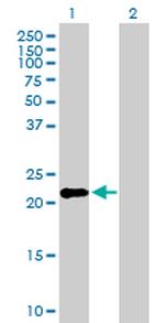 IFNK Antibody in Western Blot (WB)