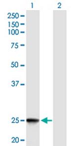 IFNK Antibody in Western Blot (WB)