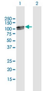 RAD18 Antibody in Western Blot (WB)