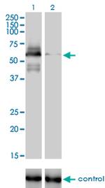 RAD18 Antibody in Western Blot (WB)