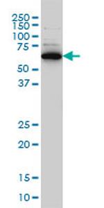 RAD18 Antibody in Western Blot (WB)