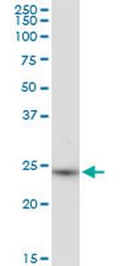 BDH2 Antibody in Western Blot (WB)