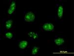 EXOSC5 Antibody in Immunocytochemistry (ICC/IF)