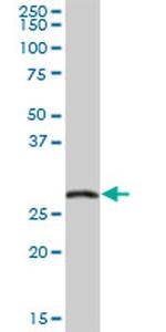 EXOSC5 Antibody in Western Blot (WB)