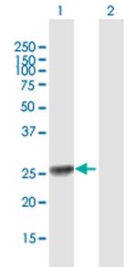 EXOSC5 Antibody in Western Blot (WB)