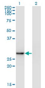 EXOSC5 Antibody in Western Blot (WB)