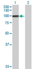 DUS3L Antibody in Western Blot (WB)