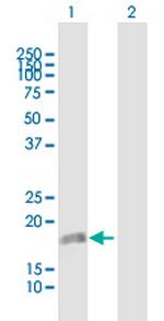 DUSP22 Antibody in Western Blot (WB)