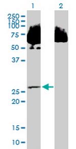 C14orf124 Antibody in Western Blot (WB)