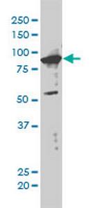 XAB2 Antibody in Western Blot (WB)