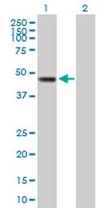 SMYD2 Antibody in Western Blot (WB)