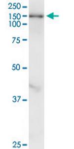 TULP4 Antibody in Western Blot (WB)