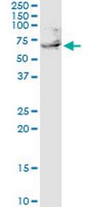 UTP3 Antibody in Western Blot (WB)