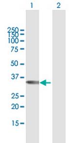 TBX20 Antibody in Western Blot (WB)