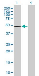 CD177 Antibody in Western Blot (WB)