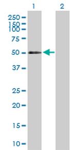 CD177 Antibody in Western Blot (WB)