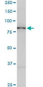 SMURF1 Antibody in Western Blot (WB)