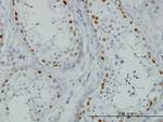 SALL4 Antibody in Immunohistochemistry (Paraffin) (IHC (P))