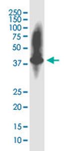 KIAA1191 Antibody in Western Blot (WB)