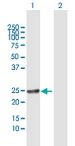 RAB22A Antibody in Western Blot (WB)
