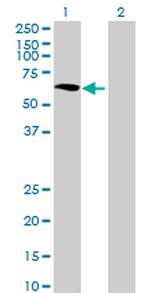 GALNTL1 Antibody in Western Blot (WB)