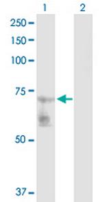 GATAD2B Antibody in Western Blot (WB)