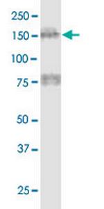 MTUS1 Antibody in Western Blot (WB)