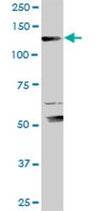 XPO5 Antibody in Western Blot (WB)