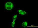 SRGAP1 Antibody in Immunocytochemistry (ICC/IF)