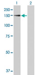 SRGAP1 Antibody in Western Blot (WB)